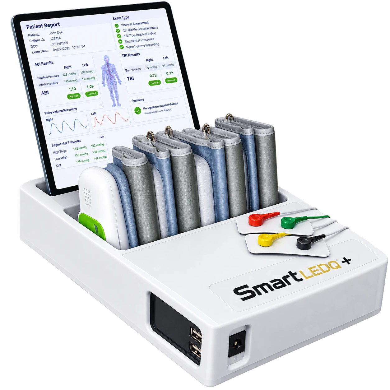 Smart-ABI System — Ankle-Brachial Index & PVR Vascular Assessment