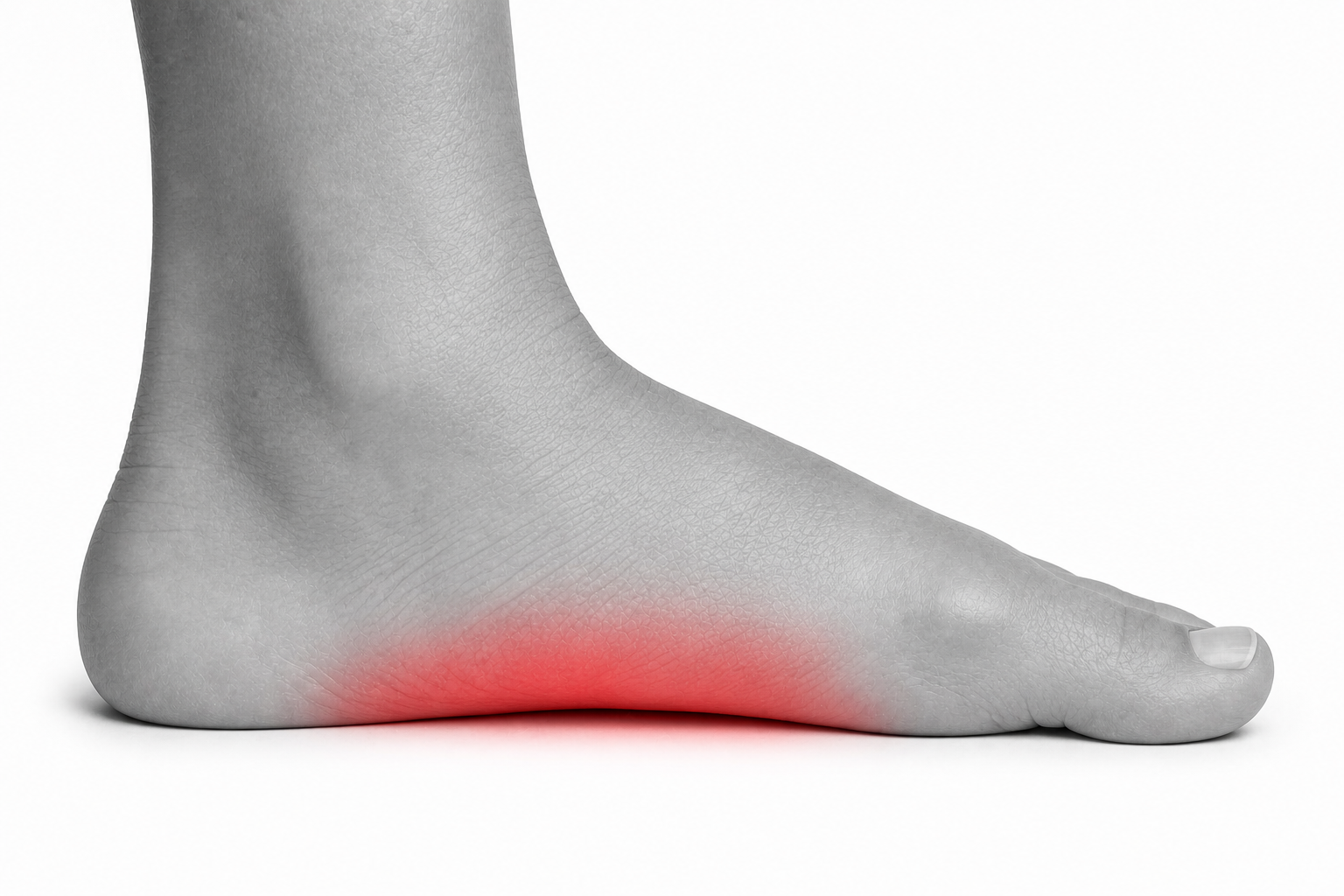 Illustration of Flat Feet