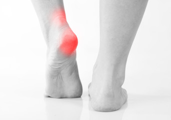 Illustration of Heel Pain